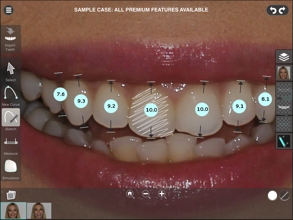 Tooth proportions and distances measured over a patient's smile