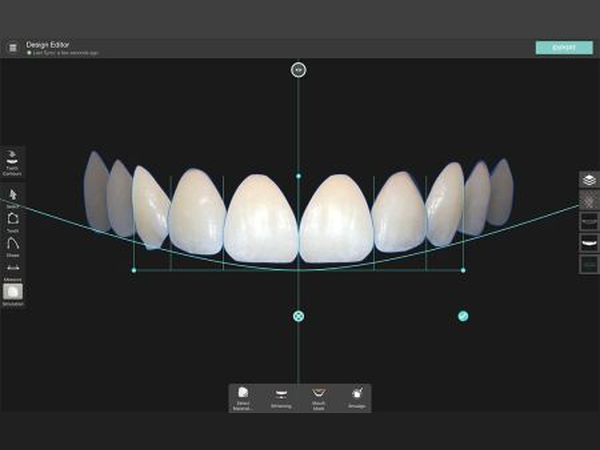 Design editor with the proposed teeth drawn along the smile curve