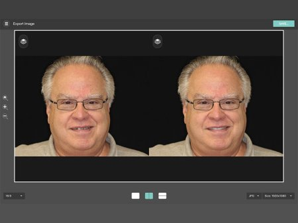Before and after of another case, ready to export